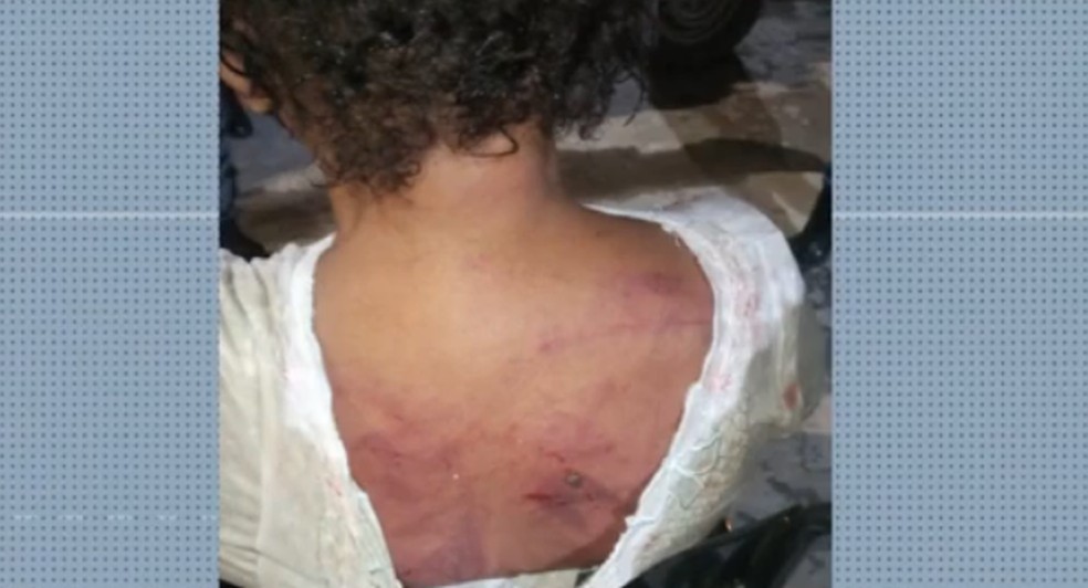 Mulher é agredida com golpes de punhal pelo ex-companheiro no MA  — Foto: Reprodução/Tv Mirante