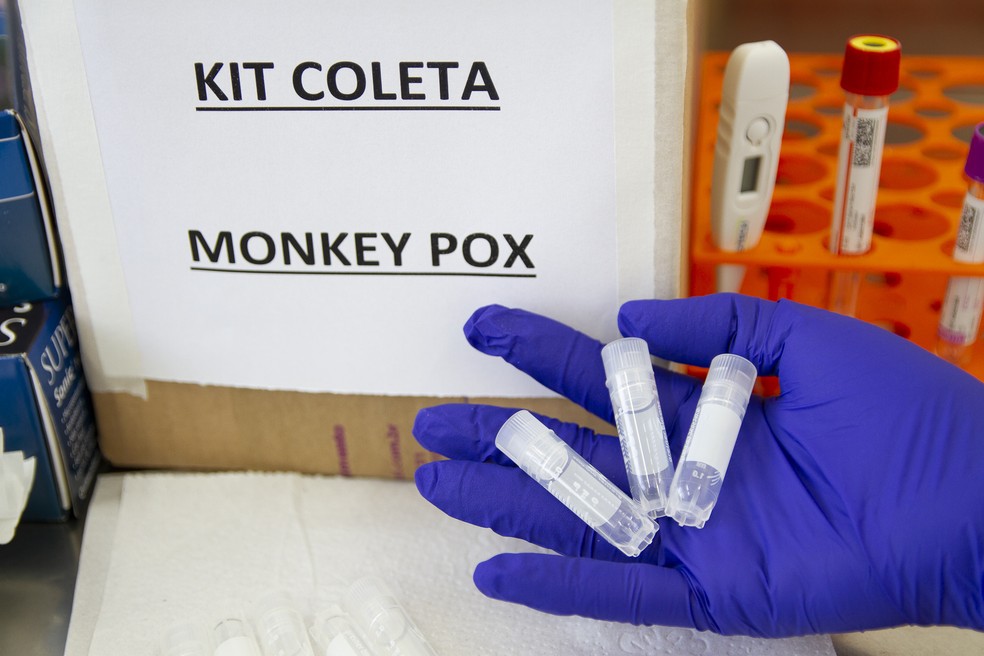 Kit de diagnóstico para varíola dos macacos é visto na Unidade Básica de Saúde (UBS) Vila Caiuba, na região noroeste da cidade de São Paulo, na manhã desta sexta-feira (5). — Foto: ADRIANA TOFFETTI/ATO PRESS/ESTADÃO CONTEÚDO