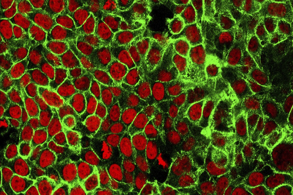 Imagem de microscópio mostra células humanas de câncer de cólon com seus núcleos corados de vermelho. — Foto: NCI/CCR/ASSOCIATED PRESS
