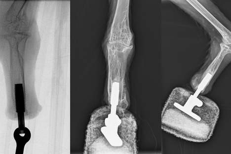 Raio-x mostra a prótese inserida na pata direita da ave Mia  (Foto: Universidade Médica de Viena )