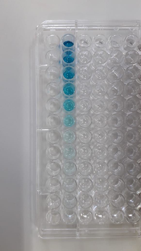 Solução muda de cor caso a pessoa tenha anticorpos contra o coronavírus (Foto: Divulgação)