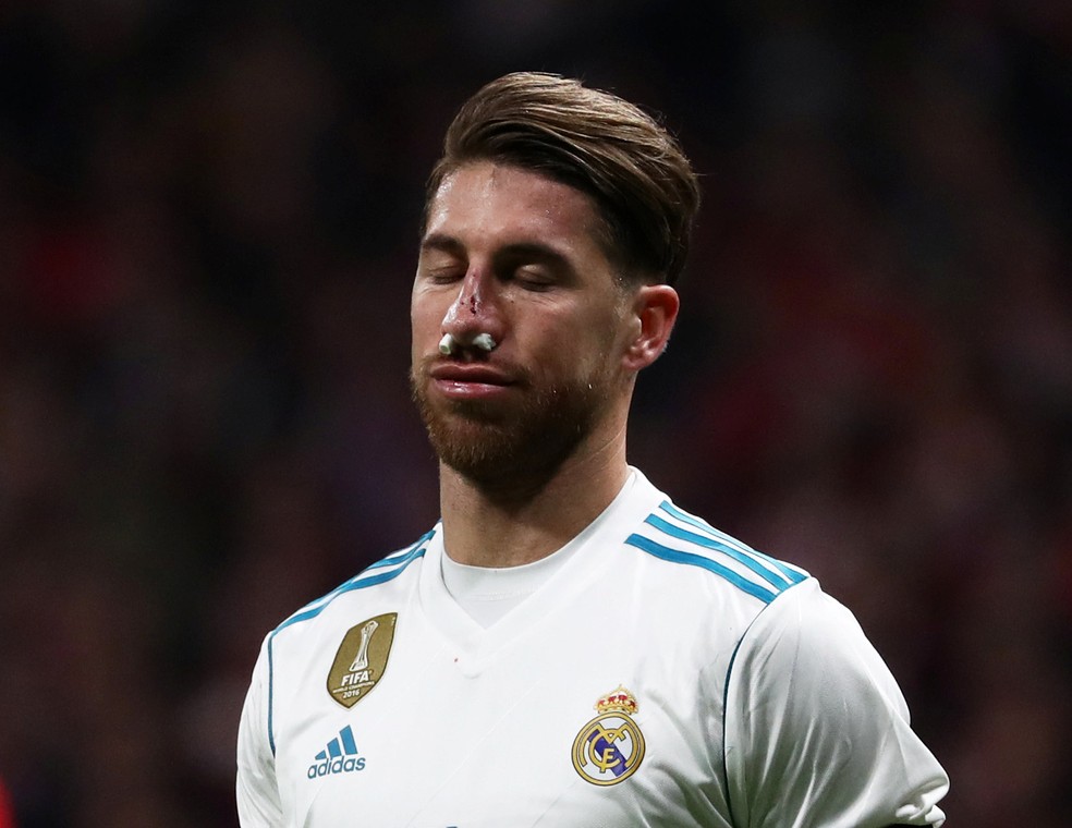Real confirma fratura no rosto de Sergio Ramos, que não 