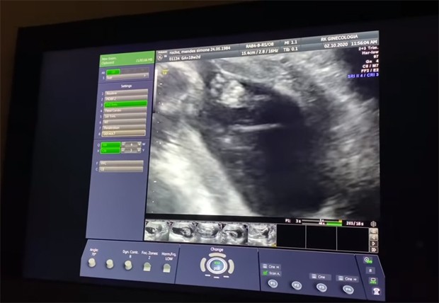 Simone mostra ultrassom da filha (Foto: Reprodução / Youtube)