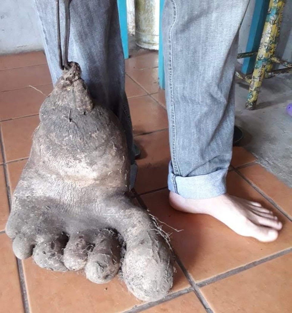 Casal colhe batata em formato de pÃ© humano em Meleiro (Foto: Marli Pedrosa Ciquinel/Arquivo pessoal)