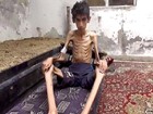 Cinco morrem por desnutrição na cidade síria de Madaya, diz ONU