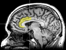 Região afetada é o síngulo anterior do córtex (Foto: wikimedia commons)