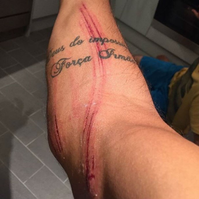 Jadson André, surfe, machucado (Foto: Reprodução/Instagram)