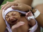 De zika a rubéola: as doenças que podem causar malformações em fetos