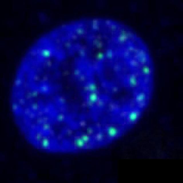Dia 3 da formação do embrião humano com quebra (verde) no DNA (azul) (Foto: Egli lab, Columbia University Irving Medical Center.)