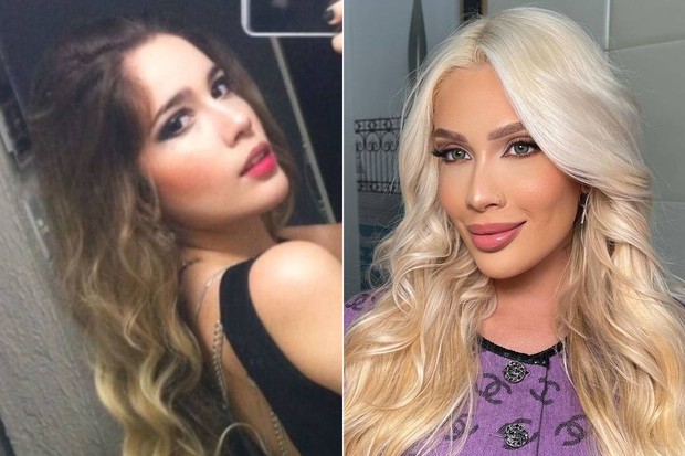 Karoline Lima antes e depois de procedimentos (Foto: Reprodução/Instagram)