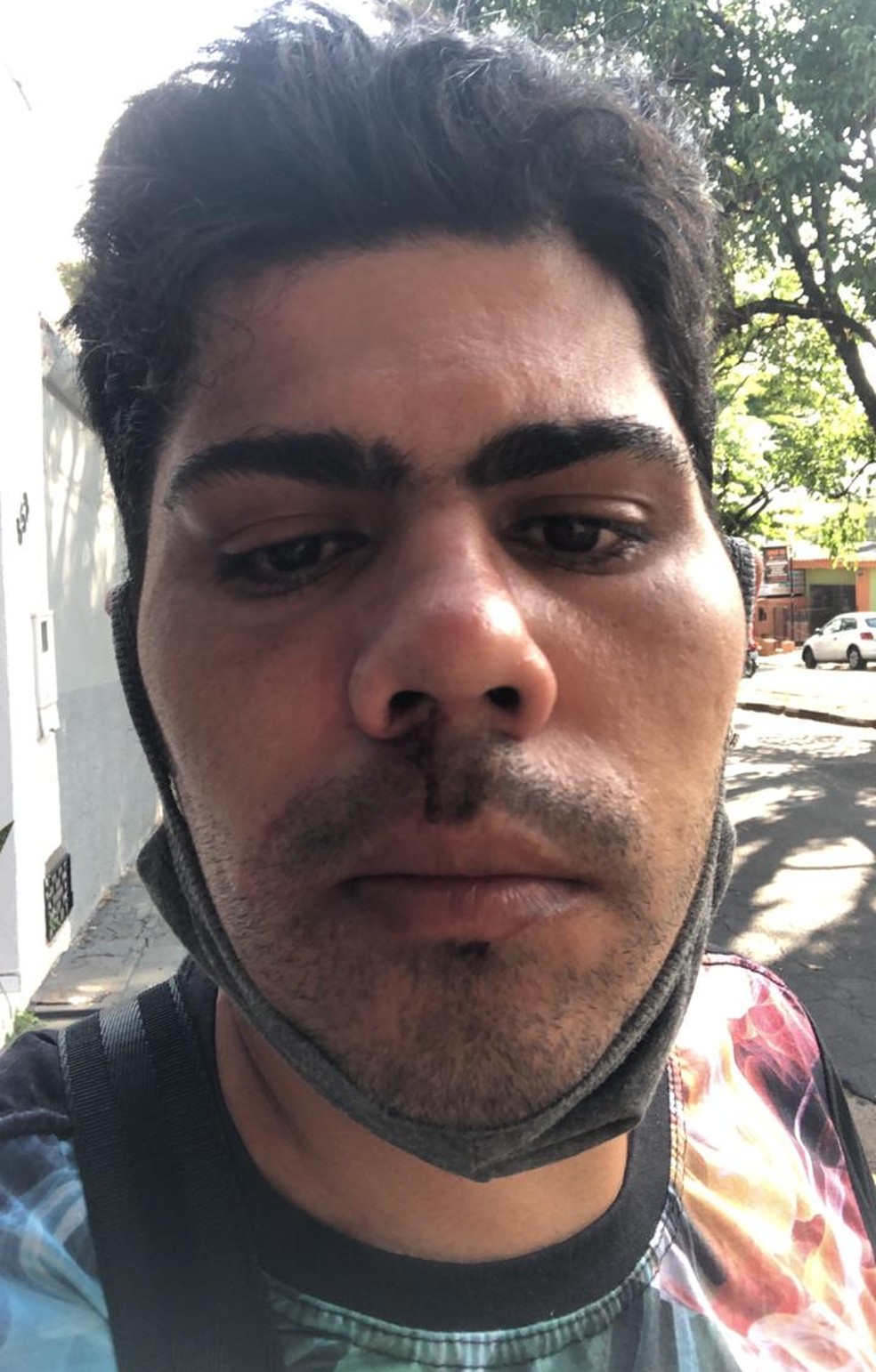 Vítima alega ter sido agredida em um banheiro público do Parque do Povo — Foto: Aline Costa/G1