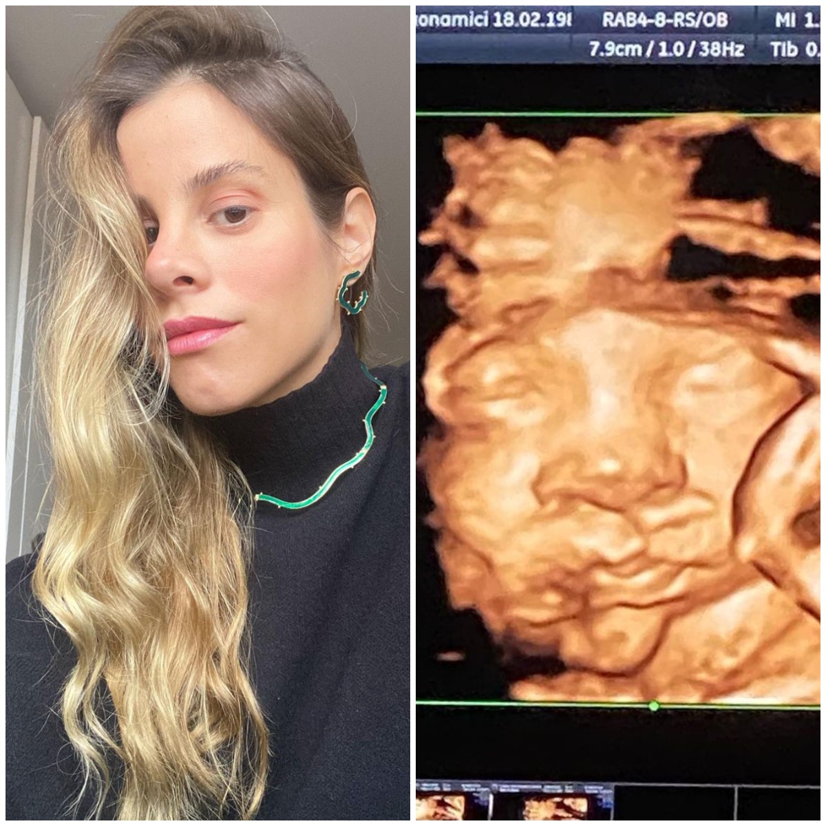 Shantal mostra foto de ultrassom e faz mistério sobre o sexo da criança (Foto: Reprodução/Instagram)