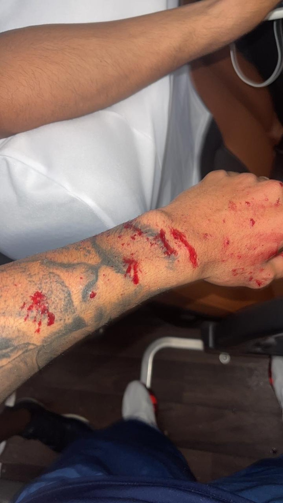 Lateral Matheus Bahia sofreu cortes nos braços em ataque a ônibus — Foto: Arquivo pessoal