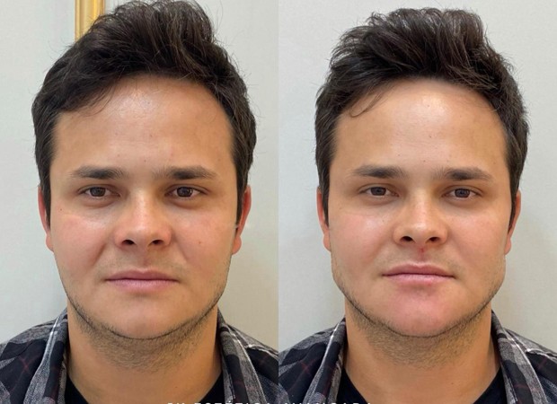 O antes e o depois de Matheus Aleixo (Foto: Arquivo Pessoal)