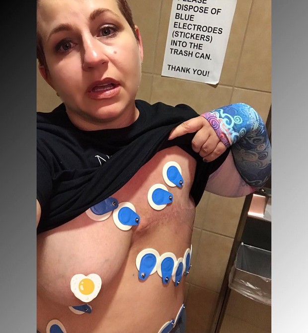 Mirelys Jimenez durante o processo de tratamento conta um câncer de mama (Foto: Reprodução Instagram)