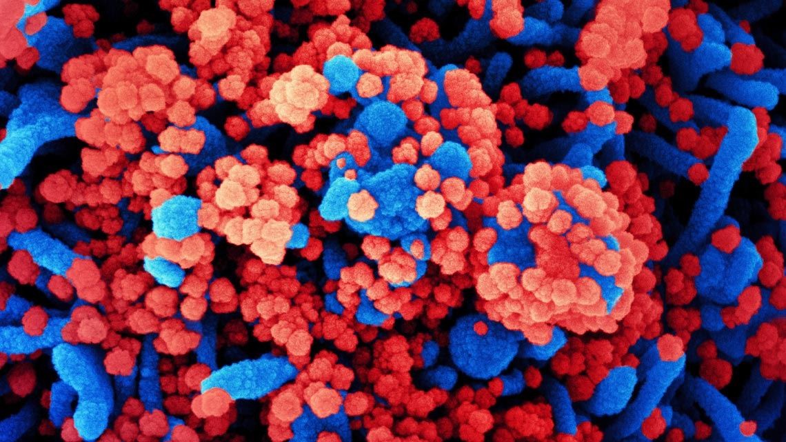 Imagem de microscopia eletrônica colorizada de uma célula humana (em azul) infectada pelo coronavírus Sars-CoV-2  (Foto: Niaid)