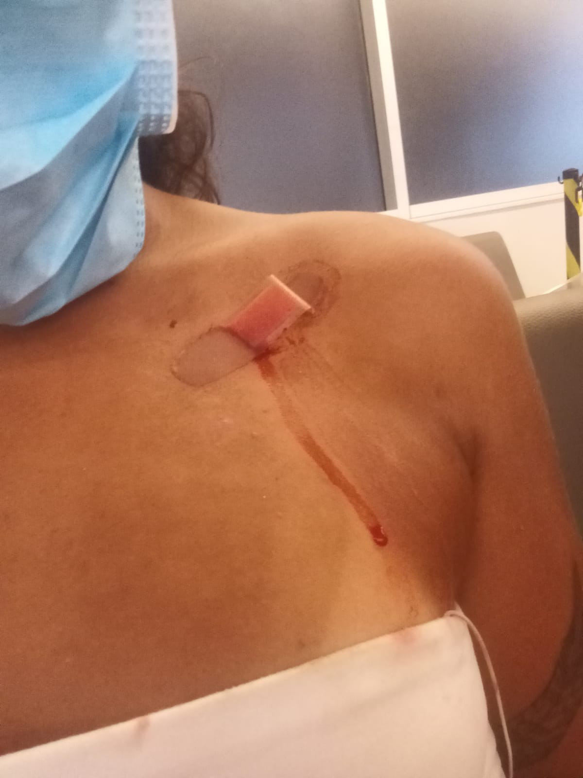 Mulher é atingida por tiro de chumbinho durante ensaio de bloco na Praça Paris, na Glória