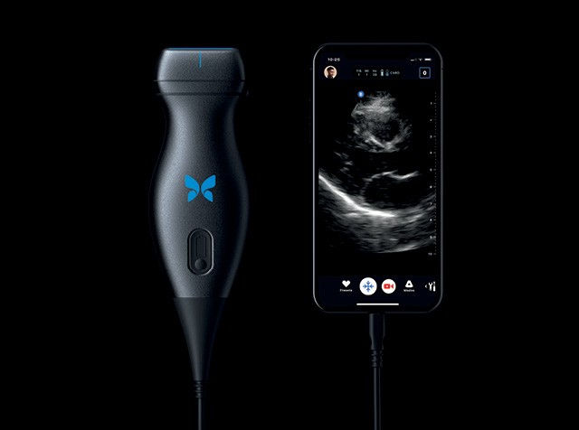 Apontada como uma das startups mais inovadoras, a ButtlerFly apresentou em Austin o iQ, aparelho de ultrassonografia portátil, cujos exames são exibidos na tela de um smartphone. (Foto: Divulgação)