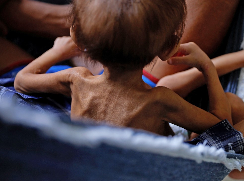 Indígenas da Terra Yanomami, a maior do Brasil, enfrentam uma grave crise humanitária, com casos de malária e desnutrição grave — Foto: Amanda Perobelli/Reuters