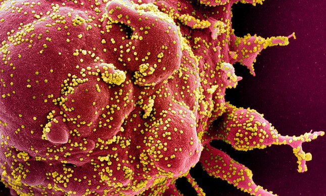 Célula infectada com partículas do novo coronavírus