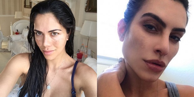 Daniela Albuquerque e Cleo sofrem de melasma no rosto (Foto: Reprodução/Instagram)