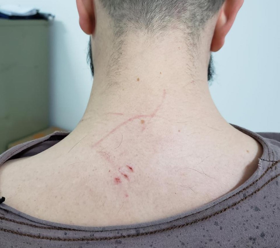 Eduardo informou que foi agredido pela maquiadora — Foto: Eduardo/Arquivo Pessoal