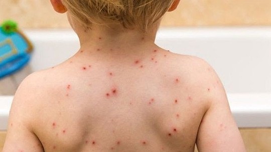 Foto: (Pref. de Três Lagoas/Divulgação)