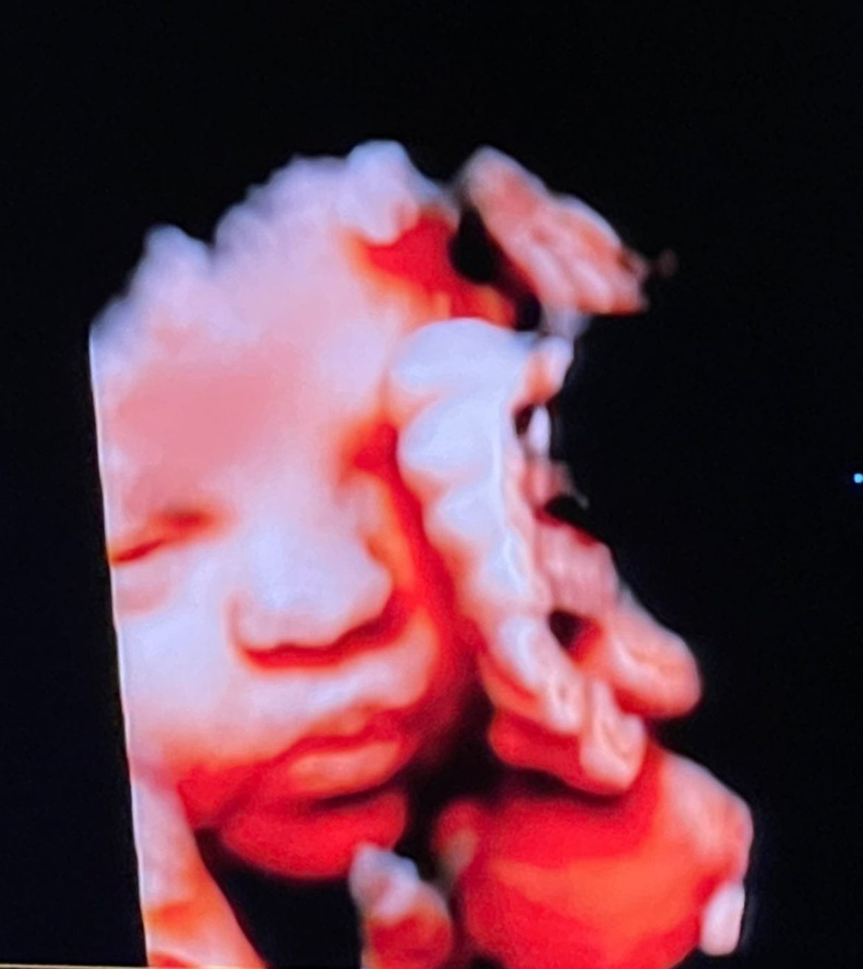 Bárbara Evans mostra rostinho da filha em ultrassom  (Foto: instagram/reprodução)