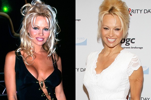 Fazem duas décadas desde que Pamela Anderson brilhou em 'Baywatch', mas a artista ainda faz o possível para manter o corpão. Ao longo dos anos ela fez várias plásticas para aumentar os seios. (Foto: Getty Images)
