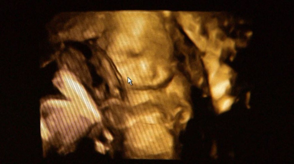 Ultrassom mostra rosto de um dos bebês no útero da avó Valdira das Neves — Foto: Reprodução