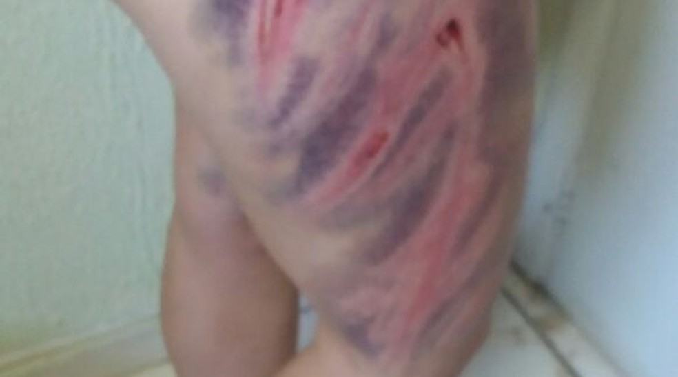 Segundo a Polícia Civil, colombiano preso em Campinas (SP) por violência doméstica agredia a mulher com uma mangueira de gás de cozinha (Foto: Polícia Civil)