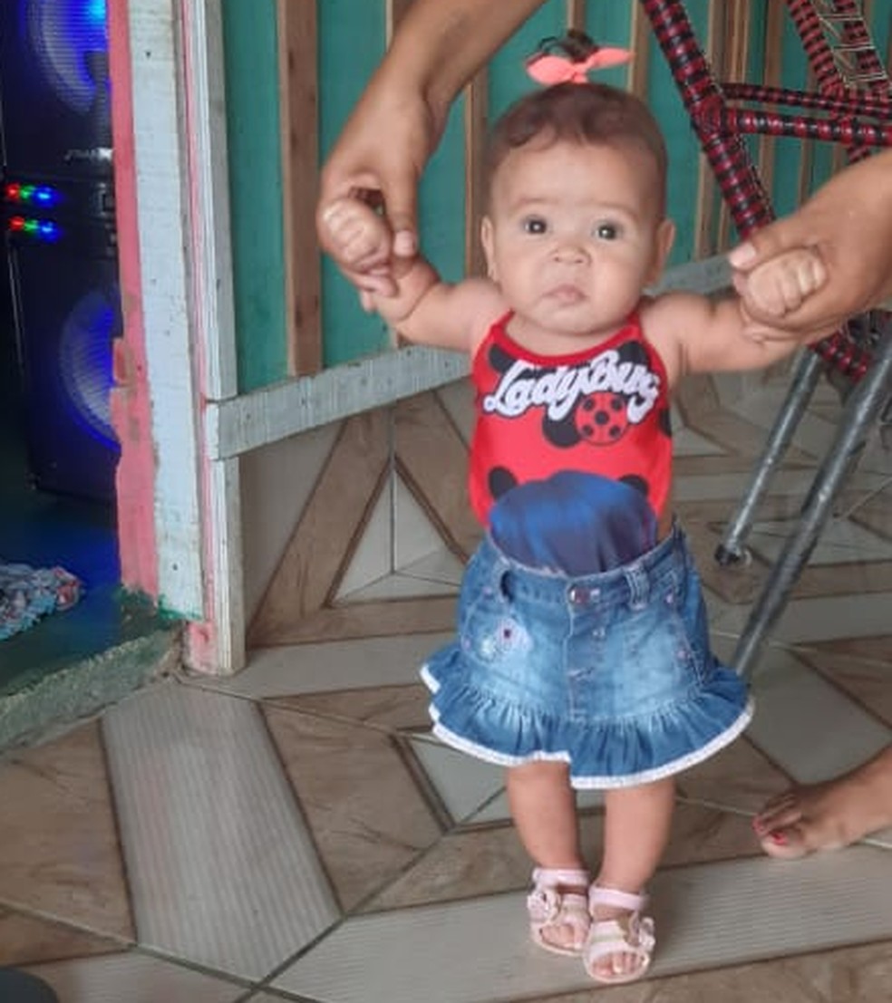Os sintomas começaram quando a menina tinha 8 meses  — Foto: Arquivo pessoal/Eriktiana de Oliveira Lopes,