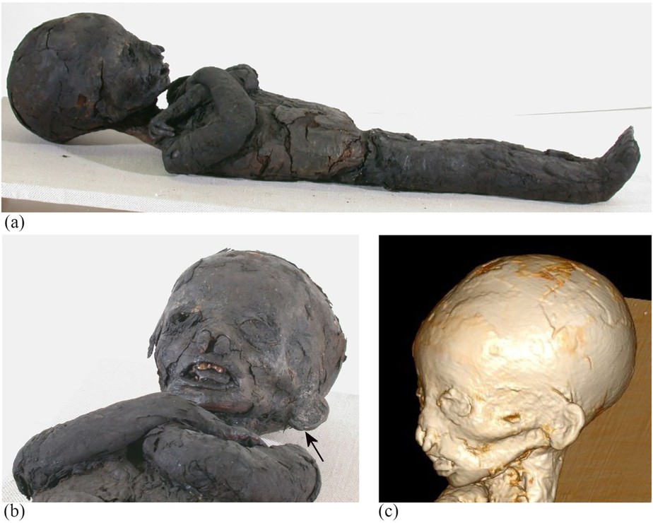 Múmia de criança em decúbito dorsal com os braços cruzados no peito (a e b) e reconstrução de tomografia computadorizada de volume 3D da cabeça (c)