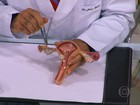 Entenda os sintomas da endometriose e saiba quais os tratamentos