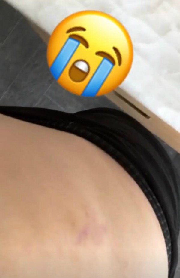 O lamento da modelo Chrissy Teigen sobre a estria encontrada em sua cintura (Foto: Instagram)