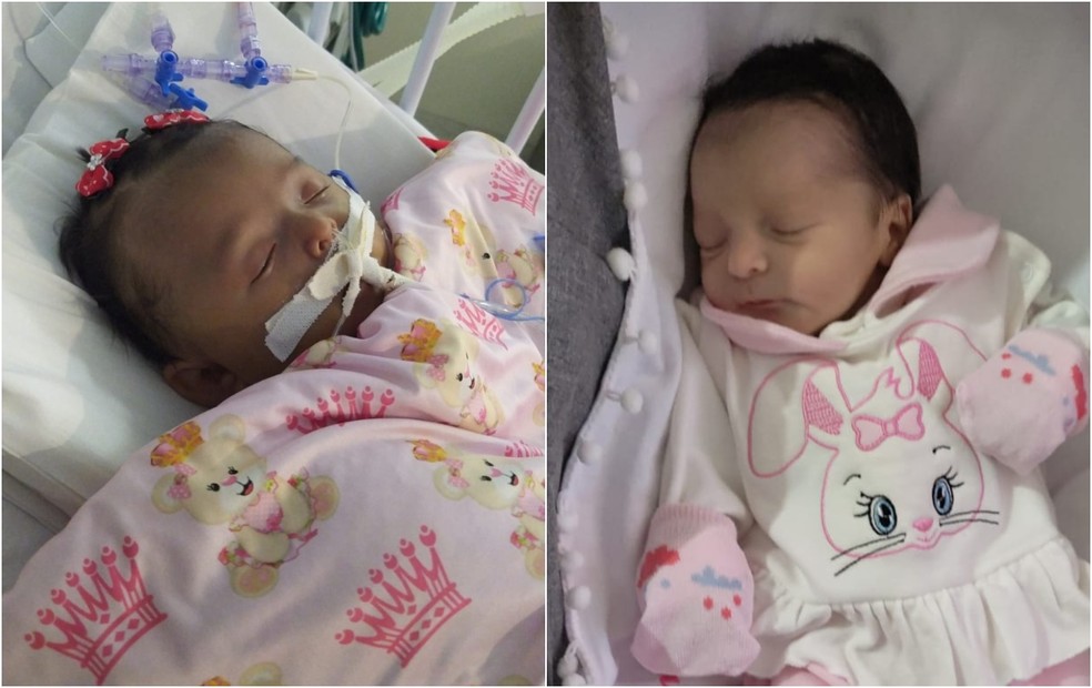 Família faz campanha para pagar cirurgias de bebê que contraiu infecção — Foto: Dalvane Rodrigues/ Arquivo Pessoal 