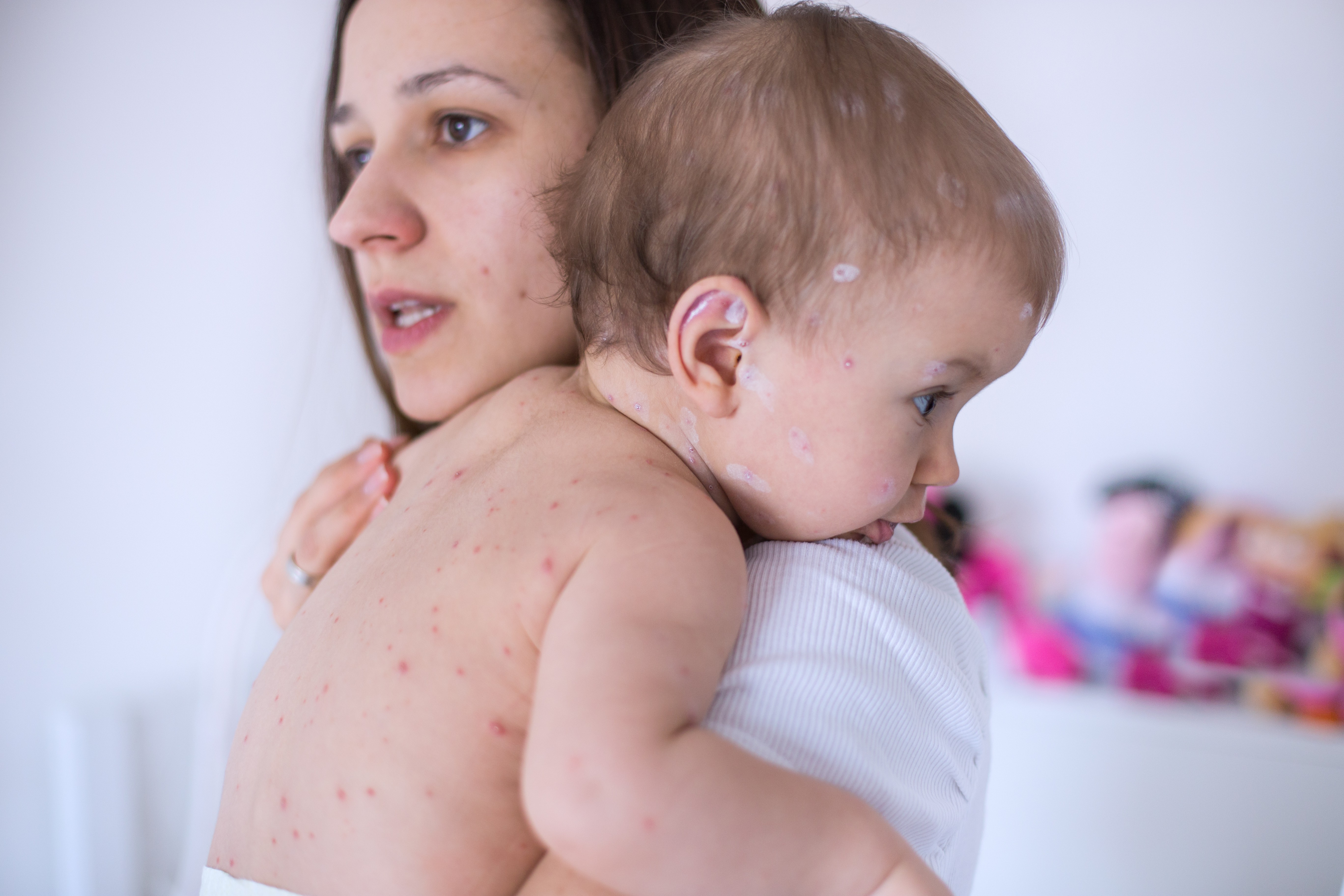 Sarampo: por que doenças consideradas erradicadas estão voltando? (Foto: Getty Images)