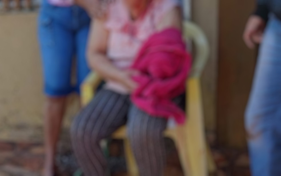 Mulher tem parte do braço amputado, em Anápolis — Foto: Divulgação/Polícia Civil