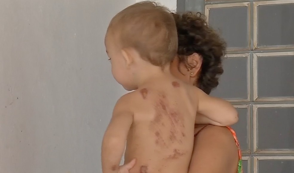 Criança e tia foram atropeladas  Foto: TVCA/Reprodução
