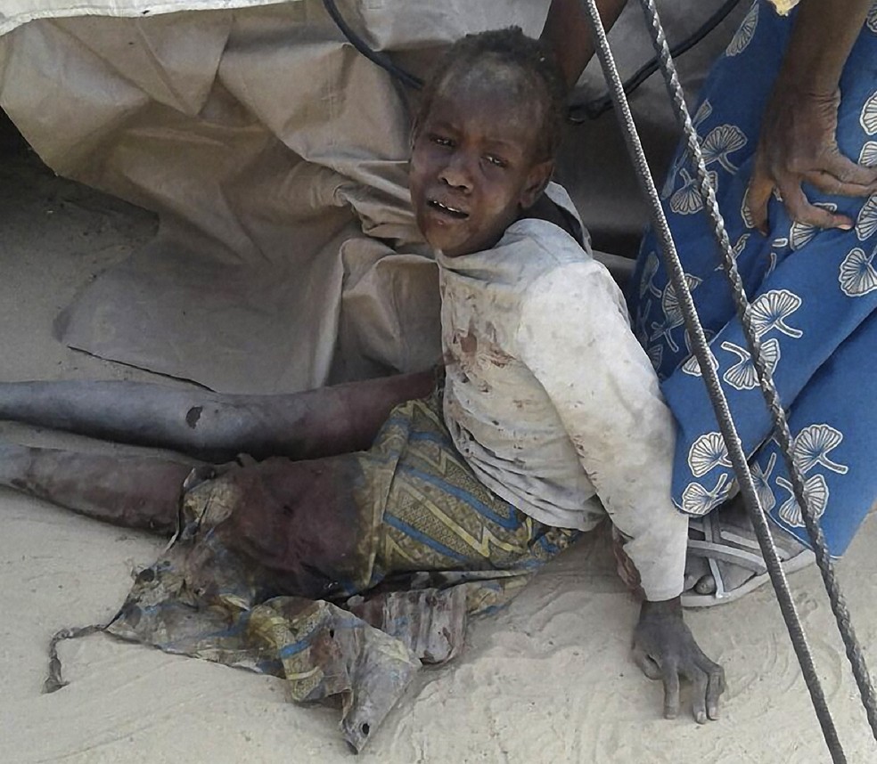 Criança ferida por bombardeio em Rann, na Nigéria, aparece chorando em imagem do Médico Sem Fronteiras (Foto: HANDOUT / MÉDECINS SANS FRONTIÈRES (MSF) / AFP)