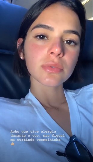 Bruna Marquezine mostra alergia em voo (Foto: Reprodução Instagram)