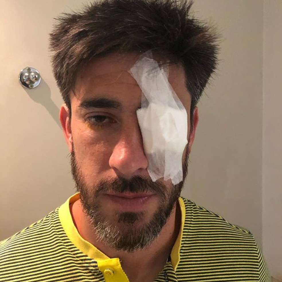 Pablo PÃ©rez, do Boca, sofreu lesÃ£o no olho apÃ³s ataque a Ã´nibus â€” Foto: ReproduÃ§Ã£o