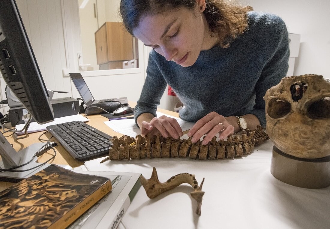 Anne-Marijn Snaaijer, candidata a doutorado na Universidade de Copenhague, examina osso de coluna no Centro de Arquivos de Trondheim na Noruega (Foto: Åge Hojem, Museu da Universidade NTNU)