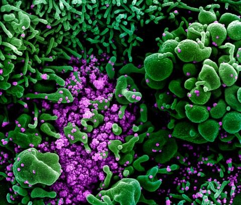 Micrografia eletrônica colorizada artificialmente de uma célula (verde) fortemente infectada com partículas do novo coronavírus (roxo), isolada de uma amostra de paciente. (Foto: NIAID-NIH)
