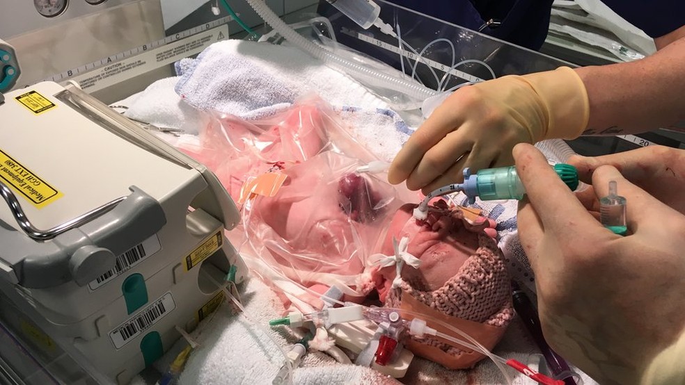 Vanellope teve de passar por três cirurgias para corrigir o problema | Foto: Glenfield Hospital (Foto: Glenfield Hospital )