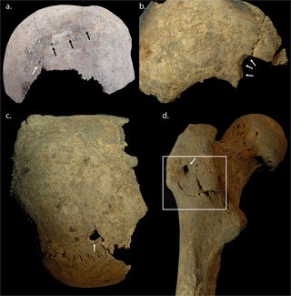 Exemplos de lesões de força penetrante dos depósitos de sepultura em massa do período do cruzado de Sidon (Foto: R. Mikulski)