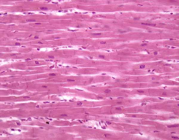 Tecido cardíaco observado do microscópio (Foto: Reprodução)