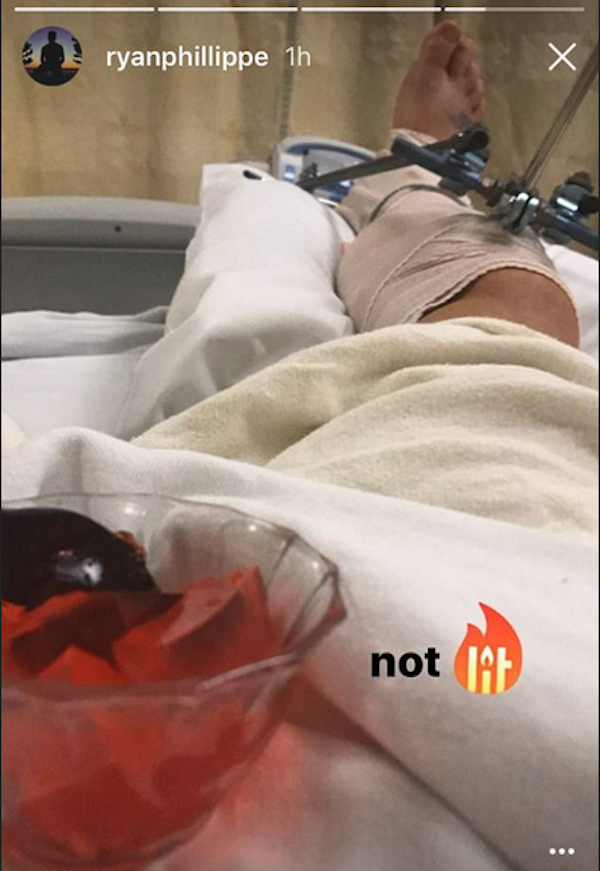 O ator Ryan Phillippe com a perna quebrada em um hospital (Foto: Instagram)