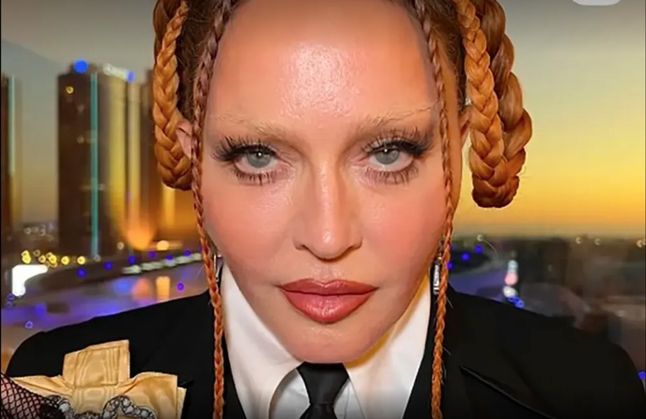 Na premiação do Grammy, a aparência de Madonna chocou fãs