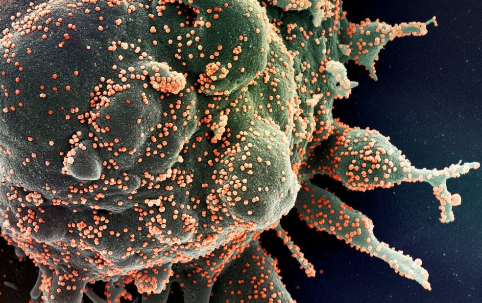 Foto microsc&oacute;pica mostra c&eacute;lula humana sendo infectada pelo Sars Cov-2, o novo coronav&iacute;rus &mdash; Foto: NIAID via Nasa